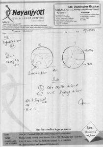 Vikram Sharma Eye Report 